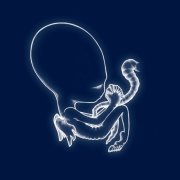 Sigur Rós - Ágætis Byrjun (1999)